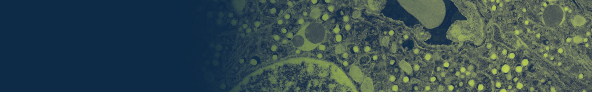 Light micrograph of pancreatic beta cells. The bright green cells contrast against the blue background.